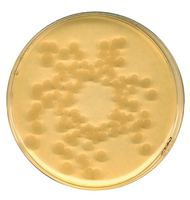TRYPTIC SOY (CASO) BROTH IRRIDIATED CASE